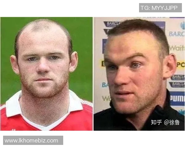 足球明星脱发排行榜揭秘谁是脱发最多的球员